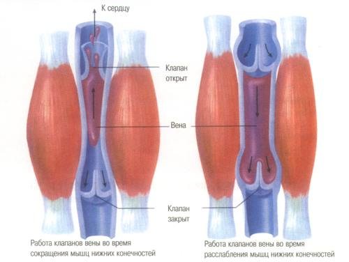 лечиться у флеболога
