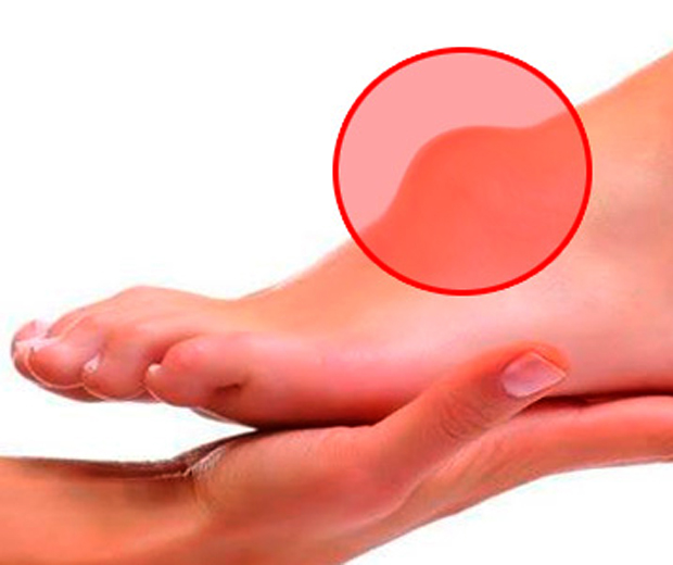 как величить гигрому