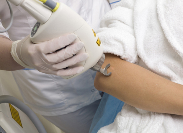 удалений рубцов от угрей