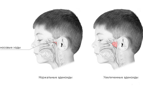 лечиться у лора