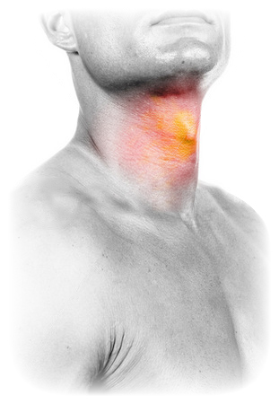 тонзиллит - как лечить