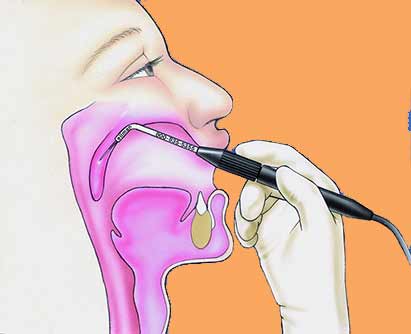 лечить храп в медицинском центре