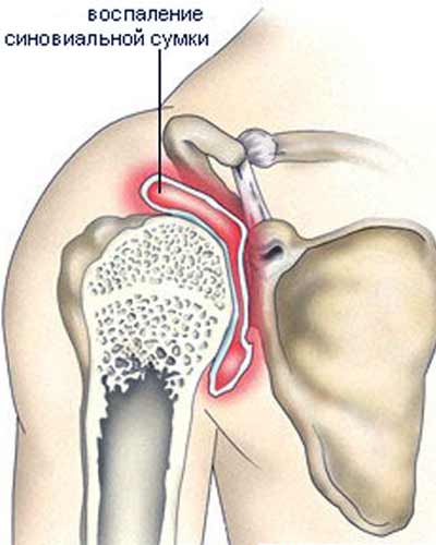 болезни суставов иди к врачу