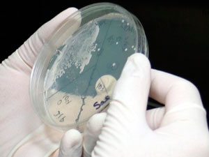 лечиться от молочницы