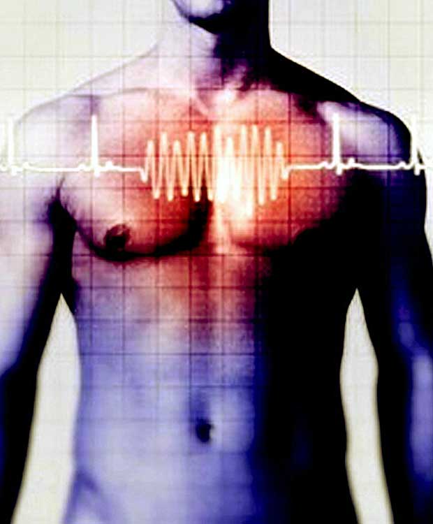 как диагностировать и лечить аритмию