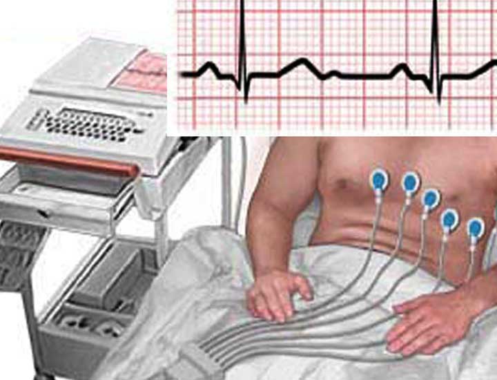 вылечить миокардит