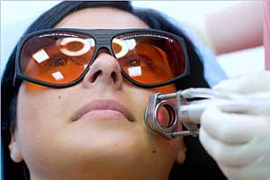 сосудистые звездочки на лице