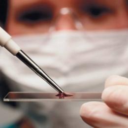 Пищевой непереносимость.