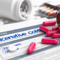 Язвенный колит, как определить